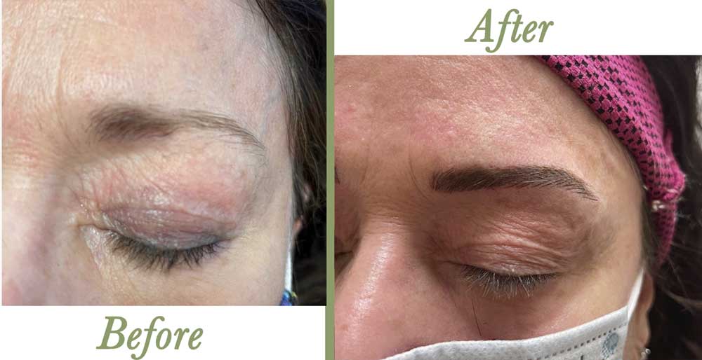 Microblading-2-2